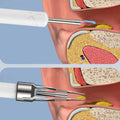 Wireless Ear Cleaner with Camera - Rechargeable Ear Wax Tool